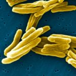 tuberculosis