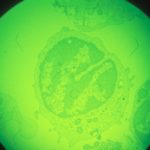 african swine fever virus