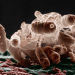 e coli bacteria