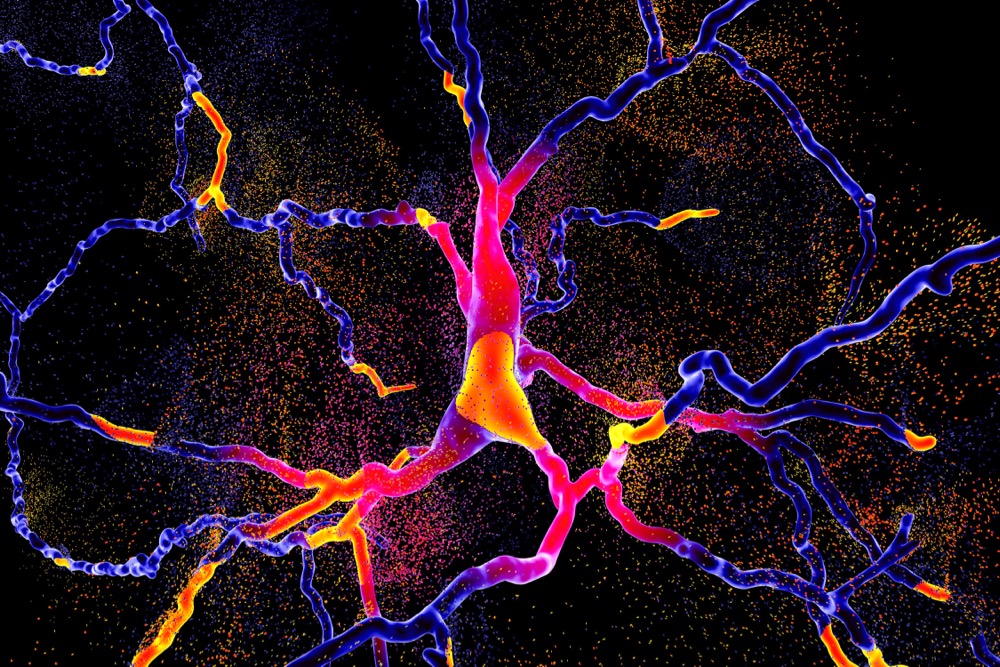 parkinsons